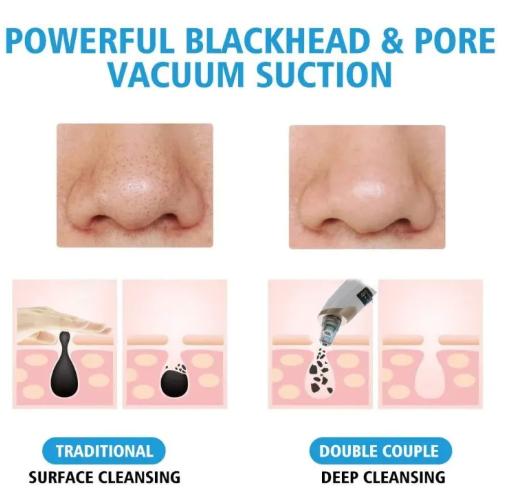 Portable Black Head Cleaner