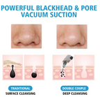 Portable Black Head Cleaner