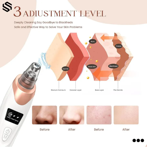 Portable Black Head Cleaner